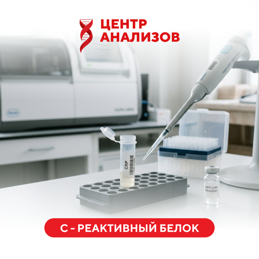 С - реактивный белок