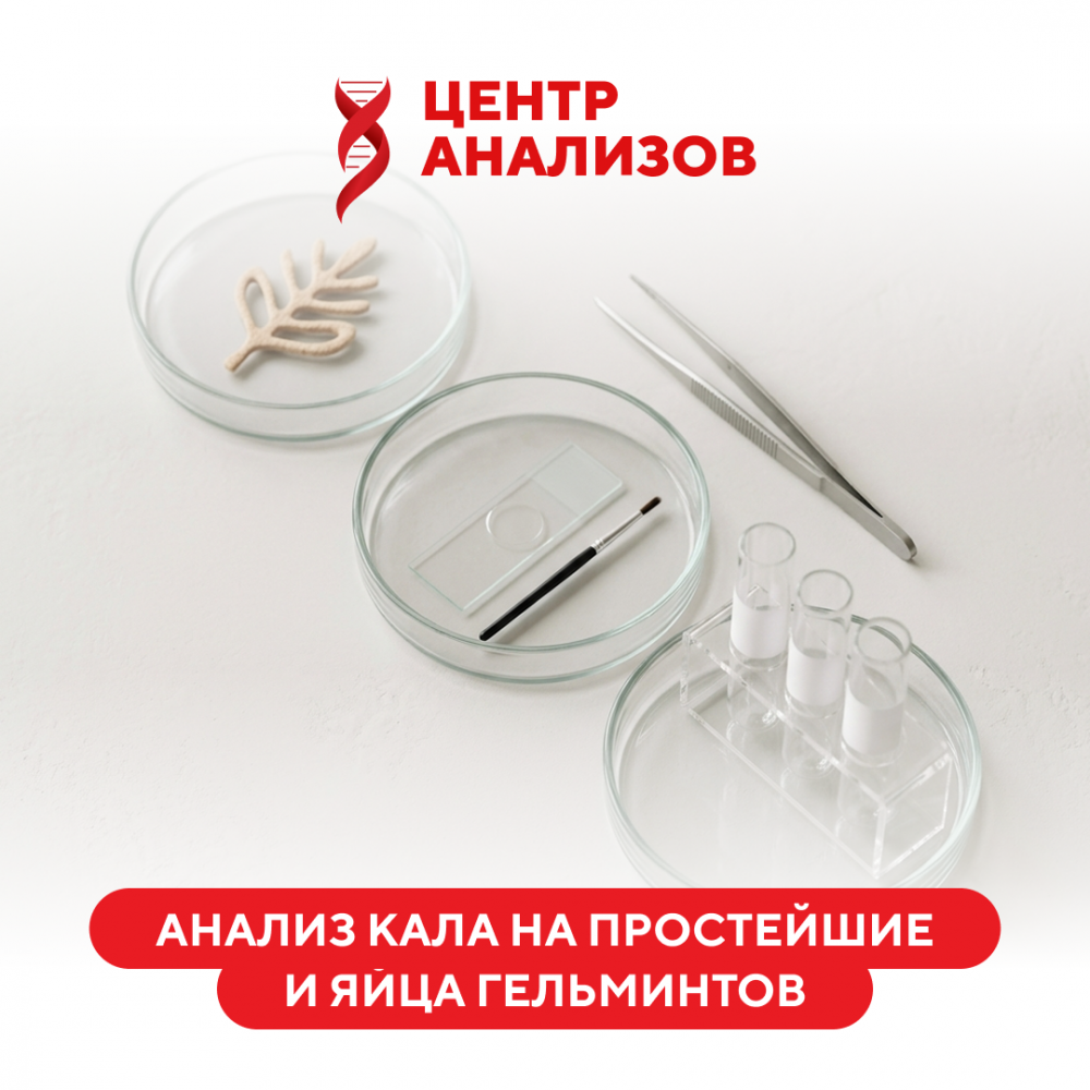Исследование кала на простейшие и яйца гельминтов