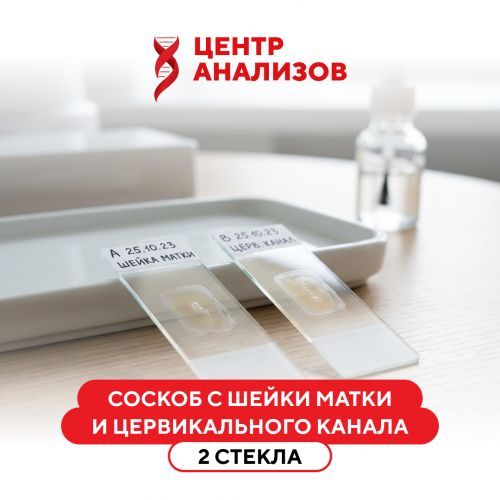 Соскоб с шейки матки и цервикального канала, 2 стекла (цитологическое исследование микропрепарата шейки матки, цервикального канала)