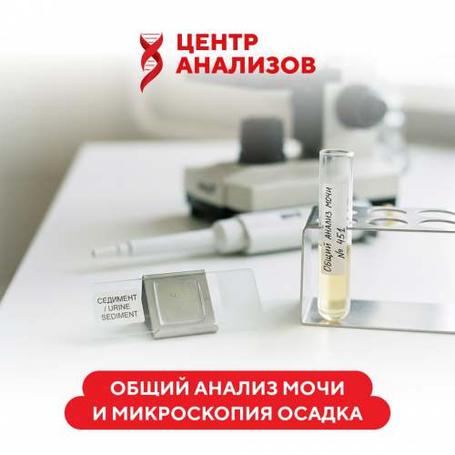 Анализ мочи на анализаторе 11 параметров + микроскопия осадка