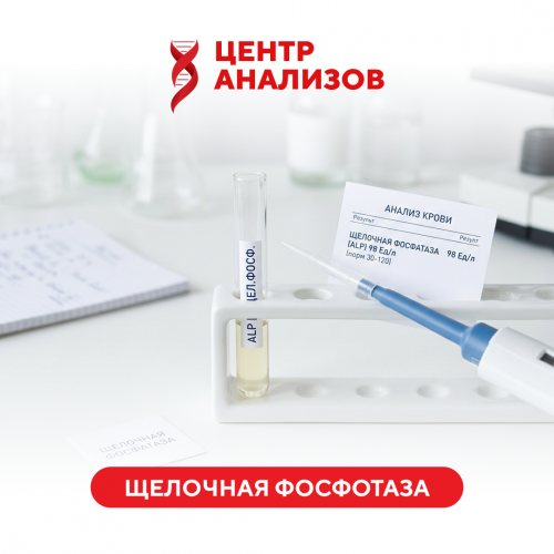 Щелочная фосфотаза