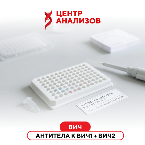 ВИЧ (антитела к ВИЧ 1 + ВИЧ 2) (ИФА)