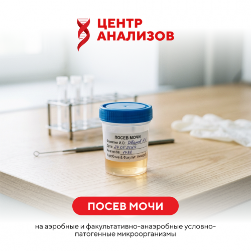 Посев мочи на аэробные и факультативно-анаэробные условно-  патогенные микроорганизмы с определением чувствительности к антибиотикам