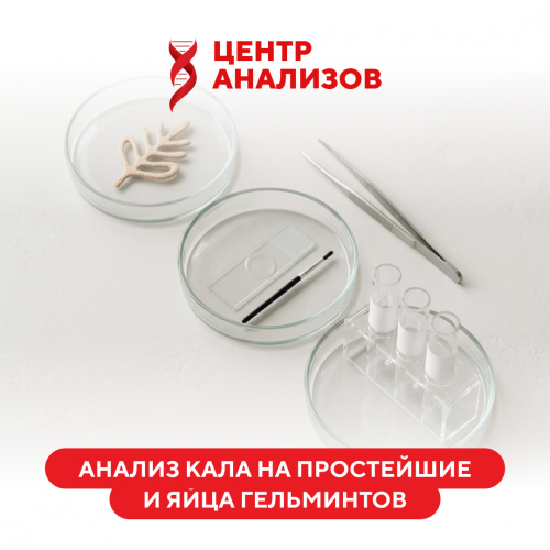 Исследование кала на простейшие и яйца гельминтов