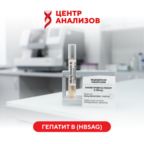 Гепатит В (HBsAg) (ИФА)